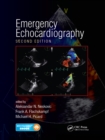 Emergency Echocardiography - eBook
