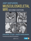 Musculoskeletal MRI - eBook