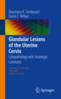 Glandular Lesions of the Uterine Cervix : Cytopathology with Histologic Correlates - eBook