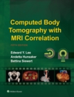 Computed Body Tomography with MRI Correlation - eBook