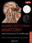 Human Sectional Anatomy : Atlas of Body Sections, CT and MRI Images, Fourth Edition - eBook