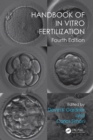 Handbook of In Vitro Fertilization - eBook
