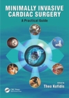 Minimally Invasive Cardiac Surgery : A Practical Guide - Book