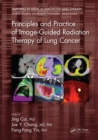 Principles and Practice of Image-Guided Radiation Therapy of Lung Cancer - eBook