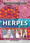 Herpes - eBook