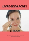 Livre-se da Acne - eBook