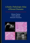 A Radio-Pathologic Atlas of Breast Diseases - eBook