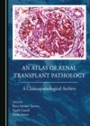 None Atlas of Renal Transplant Pathology : A Clinicopathological Archive - eBook