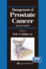Management of Prostate Cancer - eBook