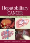 Hepatobiliary Cancer - eBook