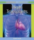 Organ Transplants - eBook