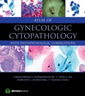 Atlas of Gynecologic Cytopathology : with Histopathologic Correlations - eBook