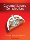 Cataract Surgery Complications - Book