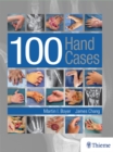 100 Hand Cases - eBook