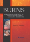 Burns : A Practical Approach to Immediate Treatment and Long-Term Care - eBook