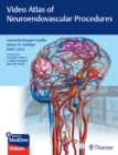 Video Atlas of Neuroendovascular Procedures - eBook