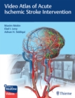 Video Atlas of Acute Ischemic Stroke Intervention - eBook