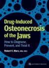 Drug-Induced Osteonecrosis of the Jaws : How to Diagnose, Prevent, and Treat It - eBook