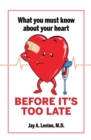 What You Must Know About Your Heart Before It's Too Late - eBook