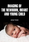 Imaging of the Newborn, Infant, and Young Child - eBook