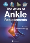 Atlas Of Ankle Replacements, The - eBook