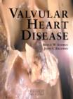 Valvular Heart Disease - eBook