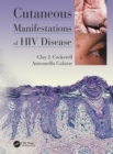 Cutaneous Manifestations of HIV Disease - eBook