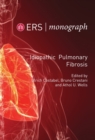 Idiopathic Pulmonary Fibrosis - eBook