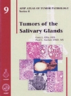 Tumors of the Salivary Glands - Book