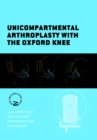 Unicompartmental Arthroplasty with the Oxford Knee - eBook