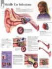 Middle Ear Infections Laminated Poster - Book