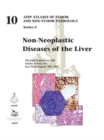 Non-Neoplastic Diseases of the Liver - Book