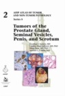 Tumors of the Prostate Gland, Seminal Vesicles, Penis, and Scrotum - Book