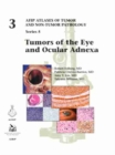 Tumors of the Eye and Ocular Adnexa - Book