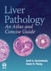 Liver Pathology : An Atlas and Concise Guide - eBook