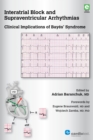 Interatrial Block and Supraventricular Arrhythmias : Clinical Implications of Bayes’ Syndrome - eBook