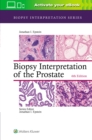 Biopsy Interpretation of the Prostate - Book