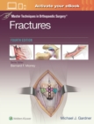 Master Techniques in Orthopaedic Surgery: Fractures - Book