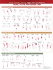 Travell, Simons & Simons' Trigger Point Pain Patterns Wall Chart : Trunk, Pelvis, and Lower Limb - Book