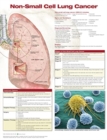 Non-Small Cell Lung Cancer, Chart Laminated - Book