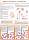Understanding Leukemia Anatomical Chart - Book