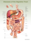 Diseases of the Digestive Tract Anatomical Chart - Book