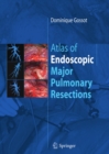 Atlas of endoscopic major pulmonary resections - eBook