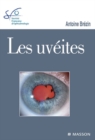 Les uveites : Rapport SFO 2010 - eBook