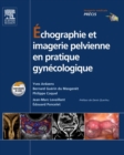 Echographie et imagerie pelvienne en pratique gynecologique - eBook