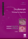 La colposcopie : Technique et diagnostics - eBook
