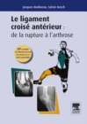 Le ligament croise anterieur : de la rupture a l'arthrose : 30e journee de traumatologie du sport de la Pitie - eBook
