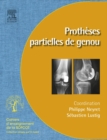 Protheses partielles du genou : Protheses unicompartimentaires et femoropatellaires - eBook
