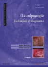 La colposcopie : Techniques et diagnostics - eBook