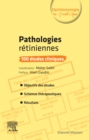 Pathologies retiniennes : 100 etudes cliniques - eBook